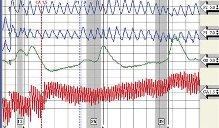 get a polygraph test in Los Angeles area today